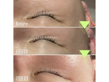 グレース(GRACE)/ラミピーリング