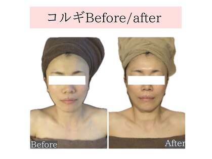 トータルビューティーサロン レビュー(REVIEW)の写真