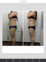 健康痩身研究所 名和店/ビフォーアフター