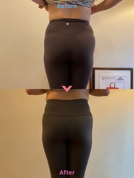 ドゥードル(doodle)/お尻のたるみも痩身マシンなら◎