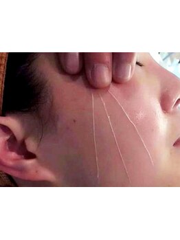 ホウレイ線・たるみ改善！予防ケア