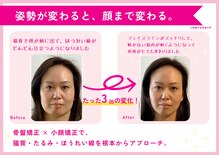 理想の小顔 福島店
