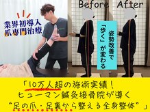 ヒューマン鍼灸接骨院の雰囲気（日本初導入、爪専門整体始まる！足の爪・足裏から整える全身整体）
