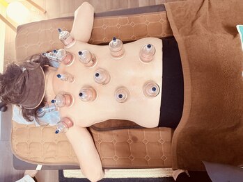 韓国 カッピング 吸い玉専門店 ラボ/現役調理のお仕事 70歳のお客様