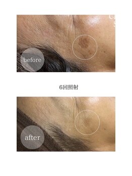 アンドエピ(&epi)/