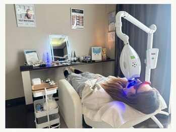 セルフダック 宮城角田店(SELFDUCK)/ホワイトニングの様子