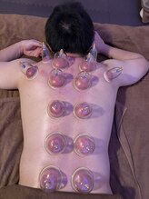 体と心の恵み/メンズも◎カッピング