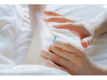 からだととのえ家さん 健美楽寿鍼灸院 整骨院の写真/初めてでも安心♪気・血・水をととのえ、からだのめぐりをサポート。リラックス空間で極上の癒やし体験を！