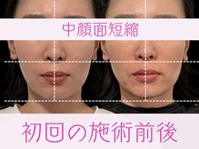 クアダ 天神(QUADA)の雰囲気（#小顔 #小顔ケア #小顔矯正 #首こり #肩こり #姿勢矯正 #天神）