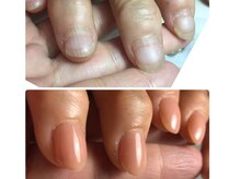 サロン ルーシュ(salon ruche)/育成ネイル