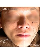 美バリ 新宿店(美BARI)/男性の方も◎