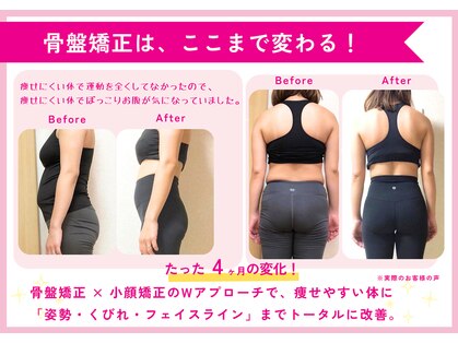 理想の小顔 福島店の写真