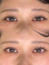 メイティー(MATEY)/ビフォーアフター