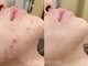 エピア 豊田店(Epia)の写真