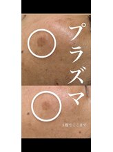 ウィンウィン 新山口店(Win Win)/シミにアプローチ