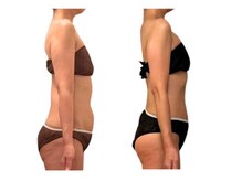 フィニシオン/50代 &nbsp;&nbsp;6ヶ月後