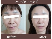ココロ(COCORO)の雰囲気（【当店人気No.1ハーブピーリング】ゆらぎ肌・肌荒れケア・美白◎）