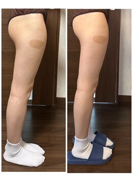 福屋/デトックスしながら脂肪燃焼！