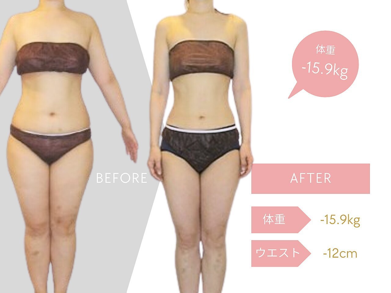 ｴﾙｾｰﾇ ﾚｯｸﾞｽﾘﾑ (数回使用のみ)定価20万円☆値下げしました - その他