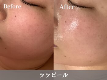 アールエイチビー 藤沢店(RHB)/