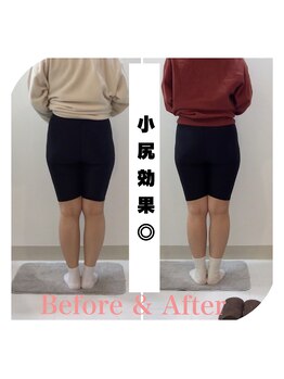 スタイルラボ高松/産後骨盤矯正の効果♪