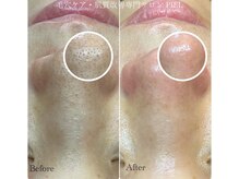 ピエル 北千住店(PIEL)/施錠後の効果が目に見えてわかる