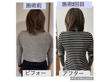 新リンパサロン 大阪の雰囲気（最先端の道具と手技でむくみがスッキリ）