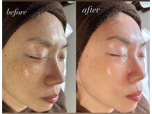 サロン ベレ プー(Salon Belle Peau)