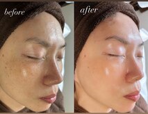 サロン ベレ プー(Salon Belle Peau)