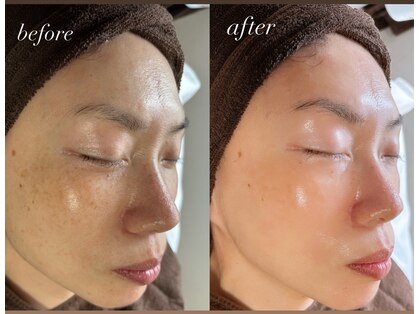 サロン ベレ プー(Salon Belle Peau)の写真