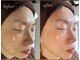 サロン ベレ プー(Salon Belle Peau)の写真