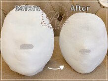 R-1ビューティーサロン 銀座/BEFORE＆AFTER