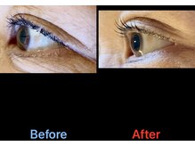 プレミアムキュア/プレミアムラッシュリフト