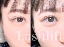 フラウ(Frau)の雰囲気（2つのトリートメント付ケラチンラッシュリフトまつげに優しい♪）