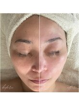 サロンドクルール(Salon de Couleur)/お客様症例♪