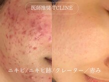 トップスキン 渋谷(TOPSKIN)