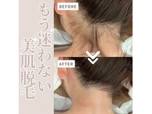 チュベルフェ(tu belle fe)/自分では見えない首周りも…♪