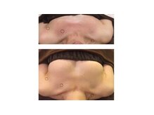 サロン ド チョコ(SALON DU CHOCO)の雰囲気（筋膜にアプローチし、バストアップを目指します！育乳◎）