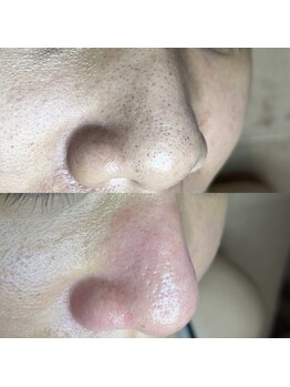 シャイニー(SHINY)/30代女性