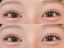 アイリー 博多(ily)/＆healthy 100本