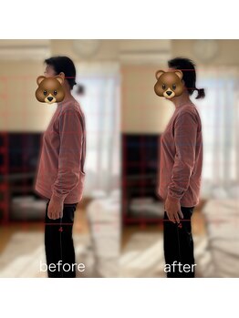 カイロプラクティック ネクサス/猫背と腰痛を撃退☆