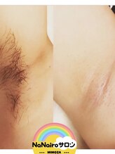 ミモザ(MIMOZA)/☆学割メニューもございます☆