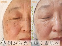 シファ(Sifa.)/ホワイトスノーピール