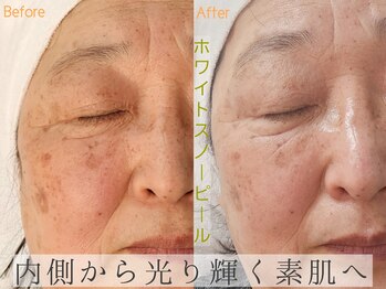 シファ(Sifa.)/ホワイトスノーピール