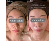 ウィム(whim)