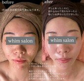 ウィム(whim)