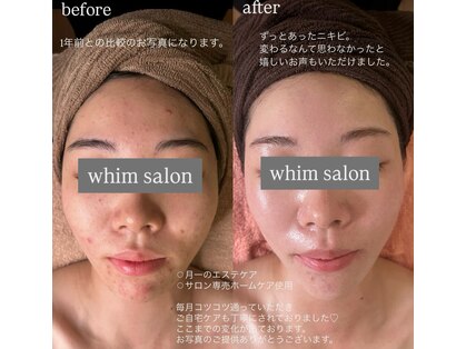 ウィム(whim)の写真