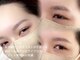 リリージョワ(Lily joie)の写真