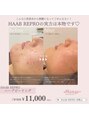 ブランジュ(Blange)&nbsp;お肌のお悩みを根本から改善したい方にオススメです！