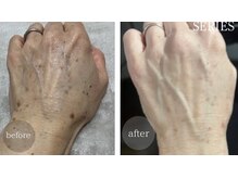 アンドエピ(&epi)/